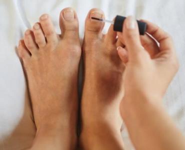 Onychomikoza pod kontrolą: jak skutecznie wyleczyć paznokcie stóp i zapobiec nawrotom