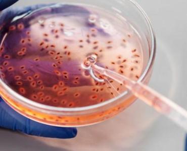 Postaw kropkę nad i w diagnostyce boreliozy: jak test Western blot potwierdza wyniki i przyspiesza drogę do zdrowia