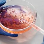 Postaw kropkę nad i w diagnostyce boreliozy: jak test Western blot potwierdza wyniki i przyspiesza drogę do zdrowia