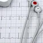 Przezprzełykowe echo serca: kiedy naprawdę warto je wykonać? Wskazania, przygotowanie i spokój ducha