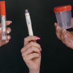 Kiedy twoje nerki proszą o głos? Sprawdź, czy to już czas na badanie moczu z markerem nefronowym