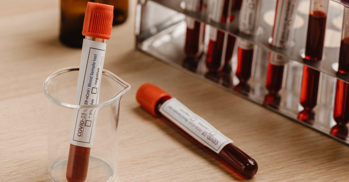 Pasożyty pod lupą: nowoczesne testy PCR z kału – kiedy warto je zrobić i co wykrywają?