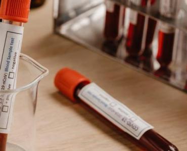 Pasożyty pod lupą: nowoczesne testy PCR z kału – kiedy warto je zrobić i co wykrywają?