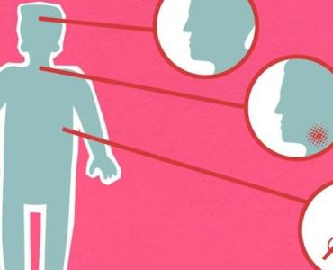 Kiedy ciało szepcze, nie krzyczy: wczesne, łagodne objawy ataksji Friedreicha, na które warto zwrócić uwagę