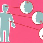 Kiedy ciało szepcze, nie krzyczy: wczesne, łagodne objawy ataksji Friedreicha, na które warto zwrócić uwagę