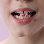 Pożegnaj wypryski na linii żuchwy: plan na trądzik hormonalny, który naprawdę działa